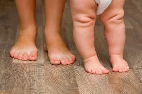 Valgus deformáció gyermekeknél