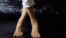 Valgus deformáció