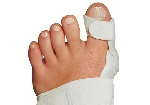 Valgus deformáció