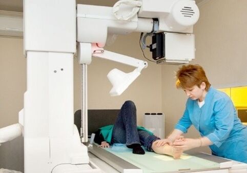 X -ray lábak